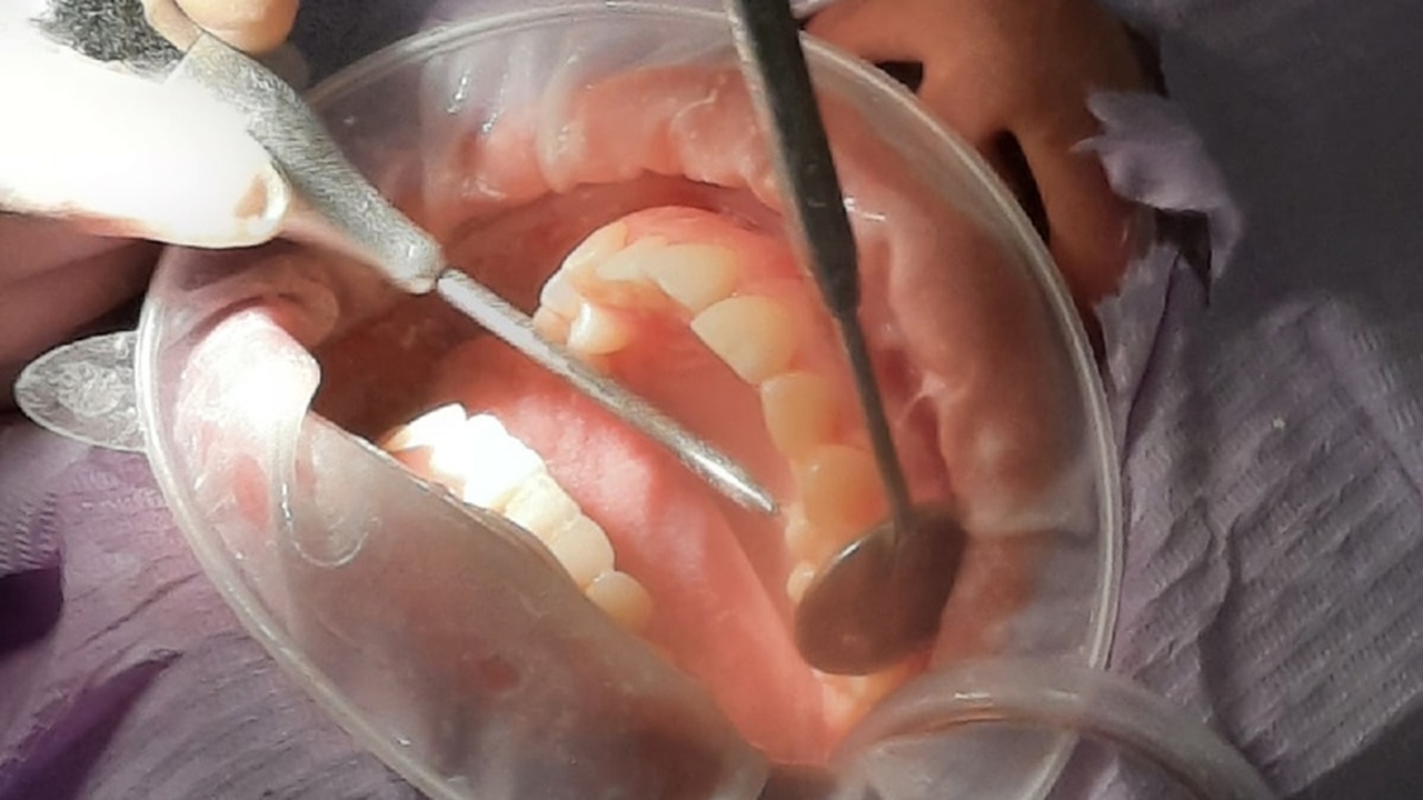 «Просто запломбируйте и все» — эту фразу стомат...