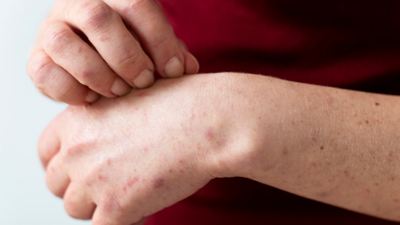 Врач-дерматовенеролог Анна Макарова предоставил...