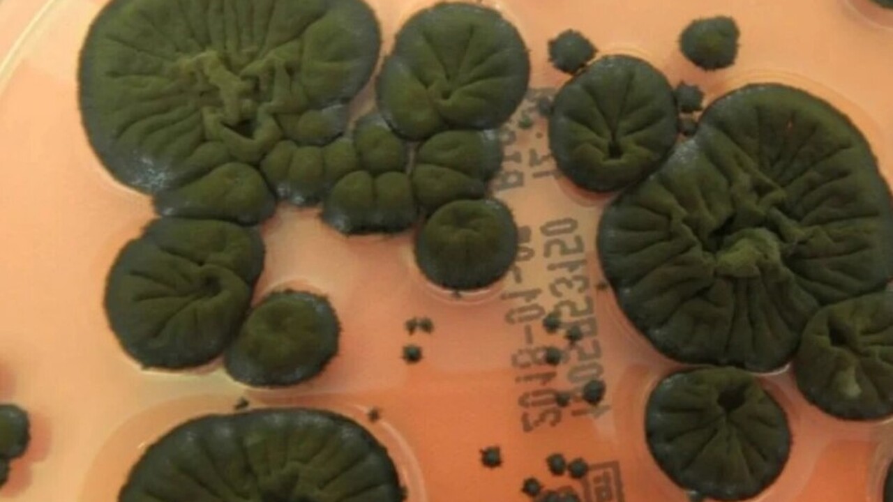 Проведено исследование: в Чернобыле найден черный гриб, питающийся радиацией В ходе комплексных исследований, проводимых в Ч...