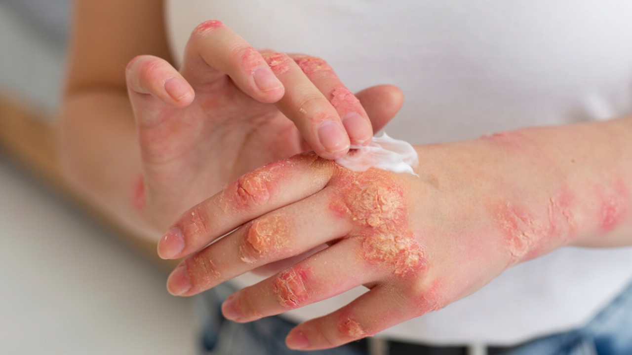 Ученые из медицинского центра Чикагского универ...