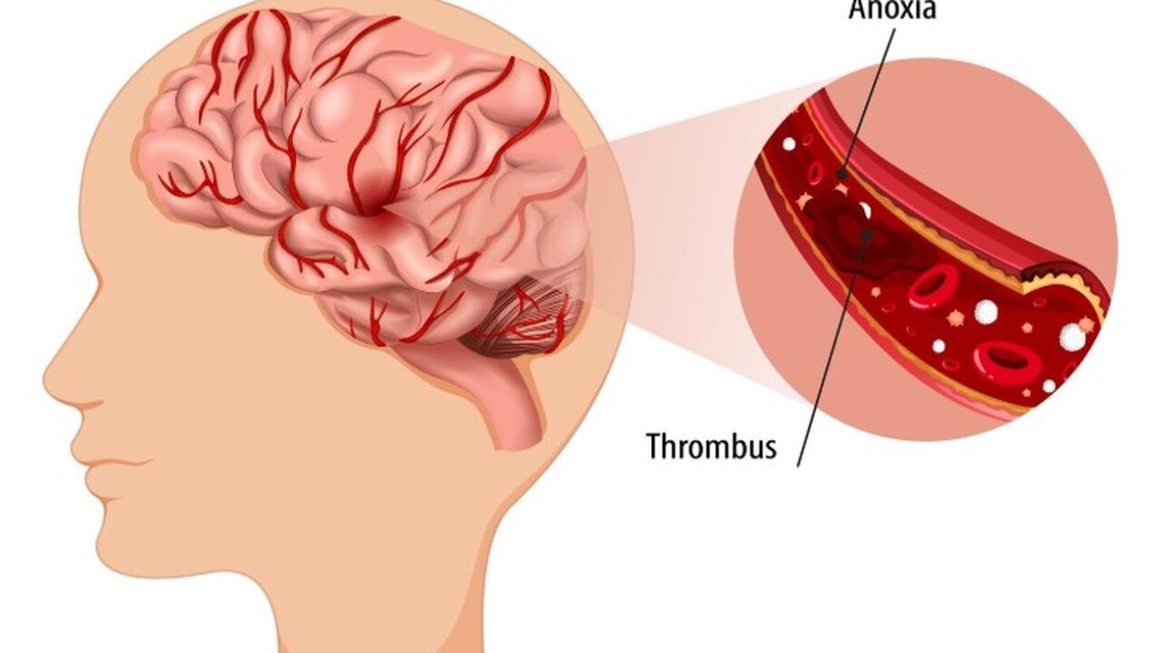 Учёные из Рочестерского университета, используя...