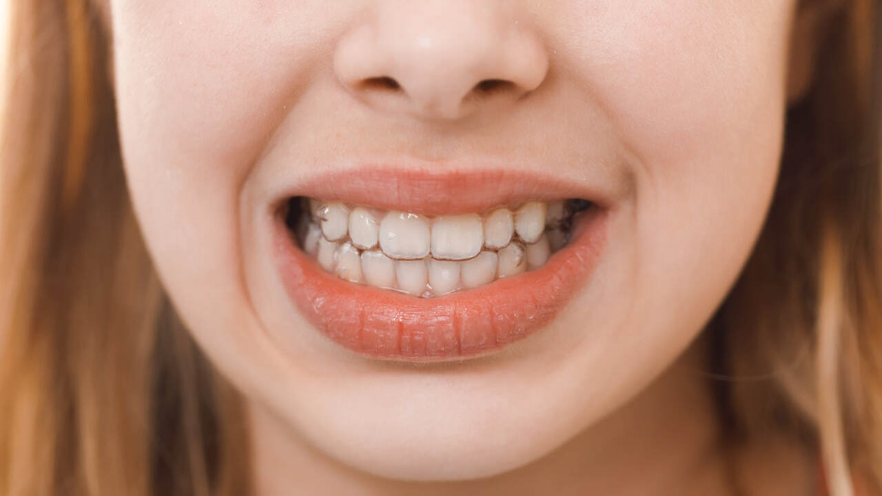 Имплантация зубов больше не ассоциируется со ст...