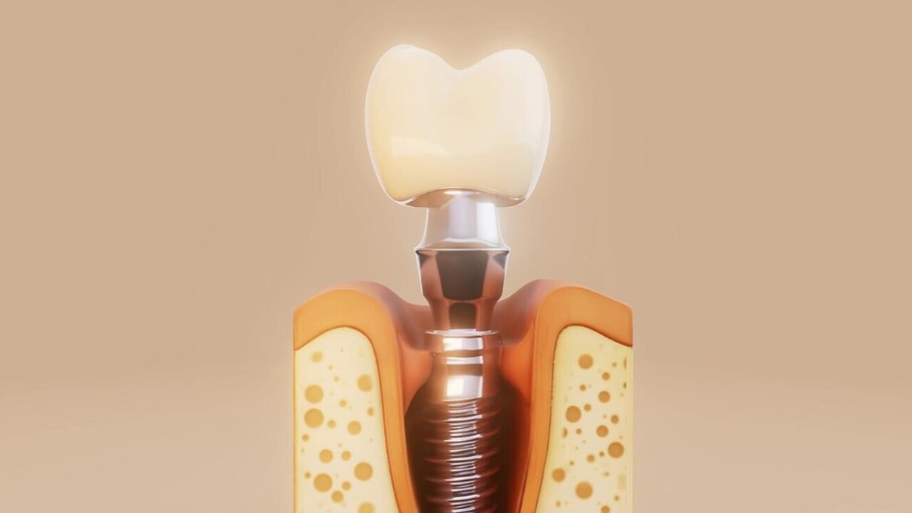 Новая разработка ученых ТПУ: биоразлагаемые костные имплантаты В Томском политехническом университете (ТПУ), в...