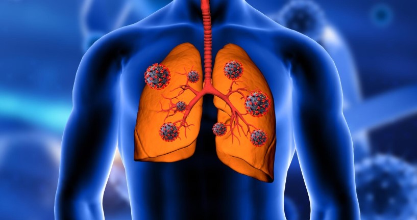  Med: умирающий мужчина двое суток провел без легких и пошел на поправку 