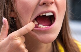 Если срочно нужен зуб: какие инновационные мето...